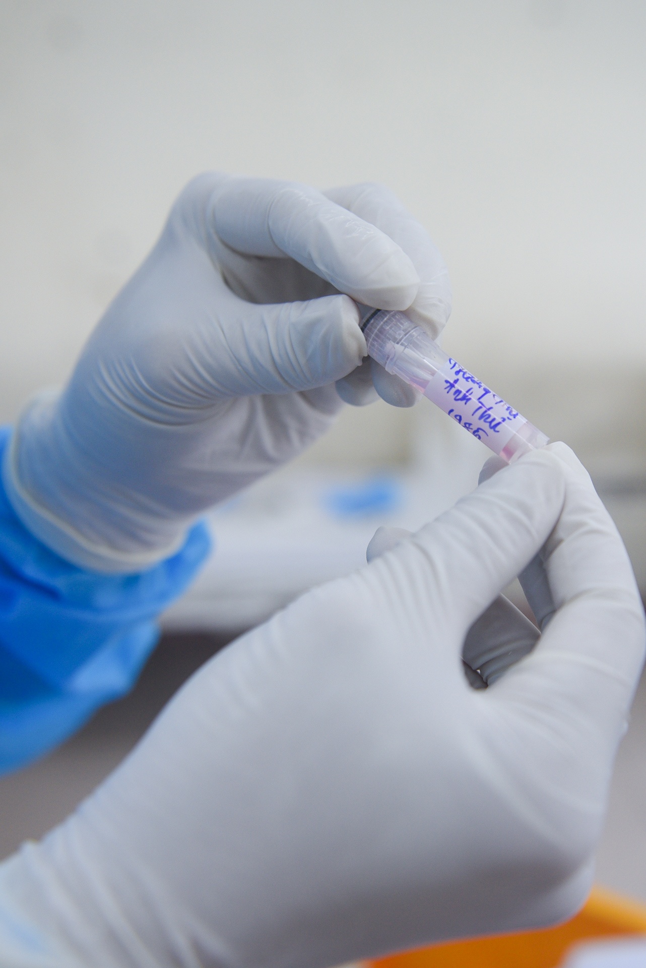 xet nghiem Covid-19 anh 4