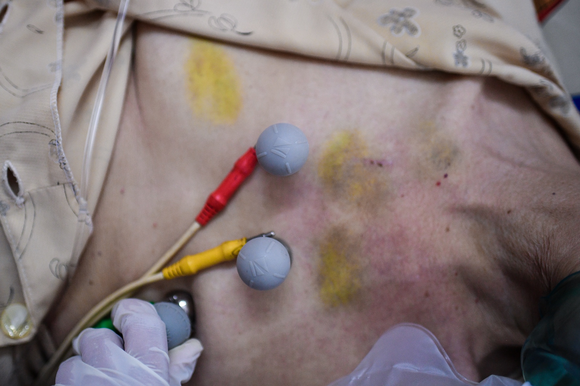 bác sĩ cấp cứu 115 ảnh 10 bac si cap cuu 115 anh 10