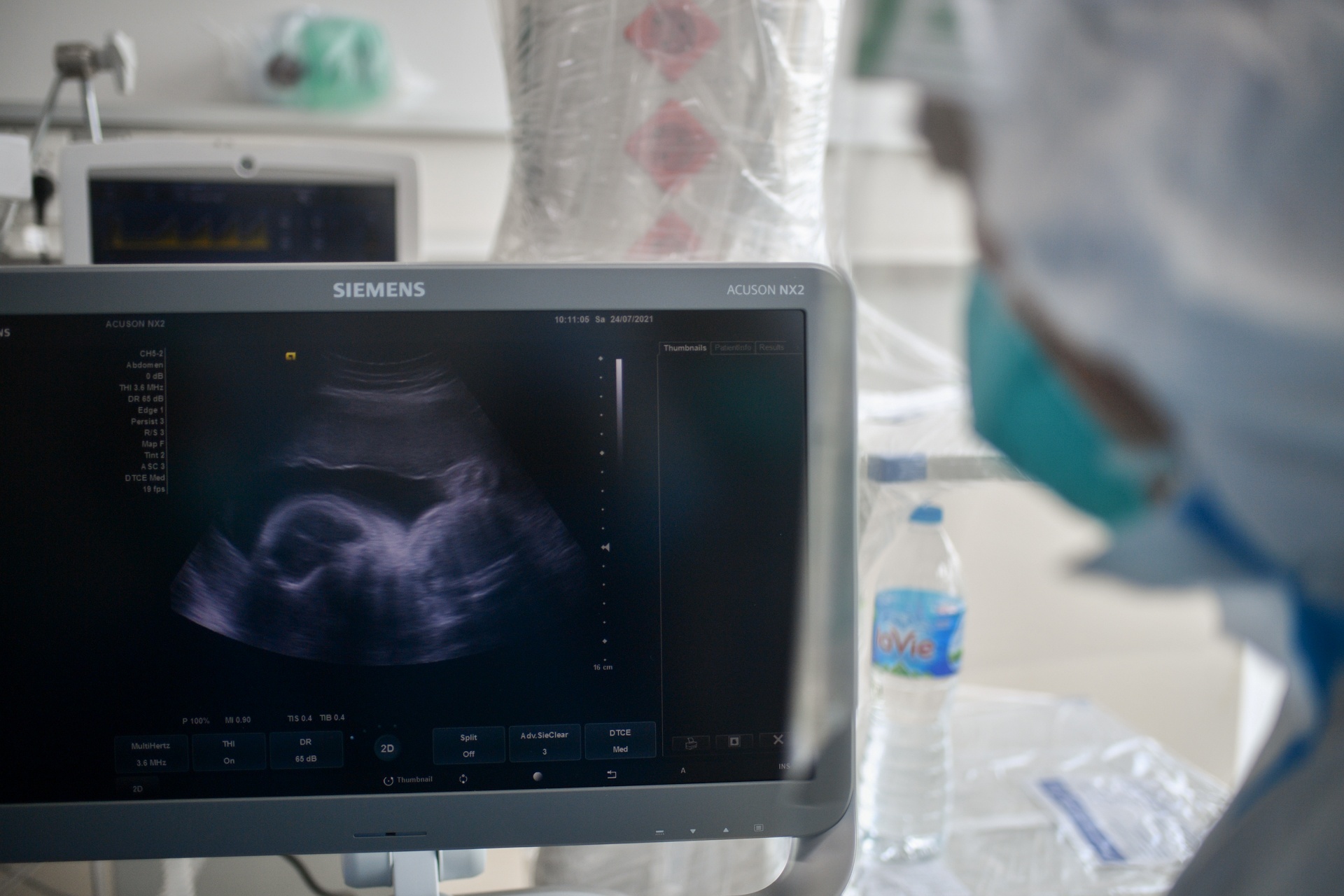 điều trị bệnh nhân Covid-19 ảnh 7 dieu tri benh nhan Covid-19 anh 7