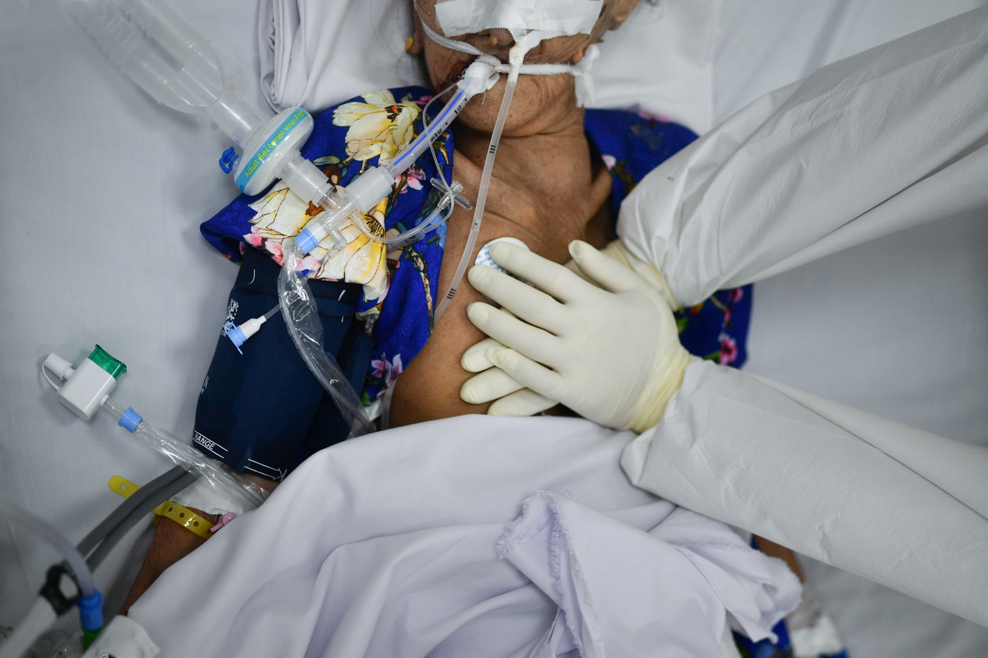 dieu tri benh nhan Covid-19 anh 1