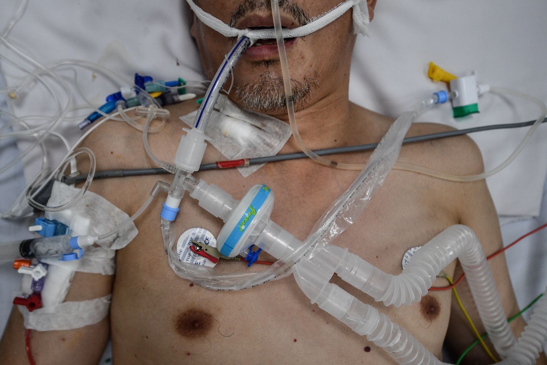 Benh vien Hoi suc mo them giuong anh 7