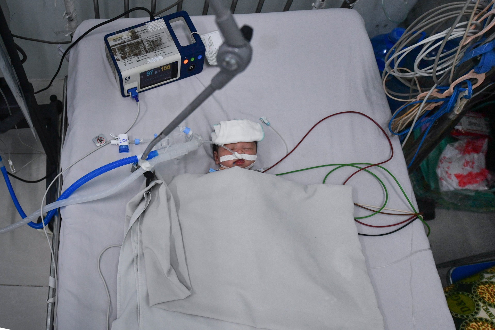 Dieu tri tre em mac Covid-19 TP.HCM anh 3