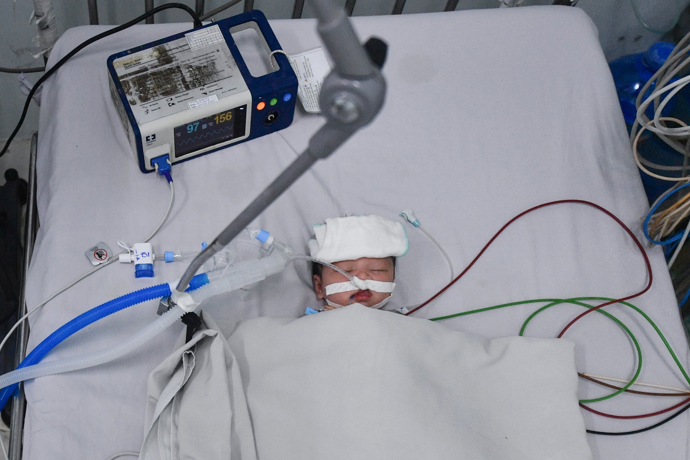 Khoa dieu tri Covid-19 cho tre em dau tien tai Viet Nam hinh anh