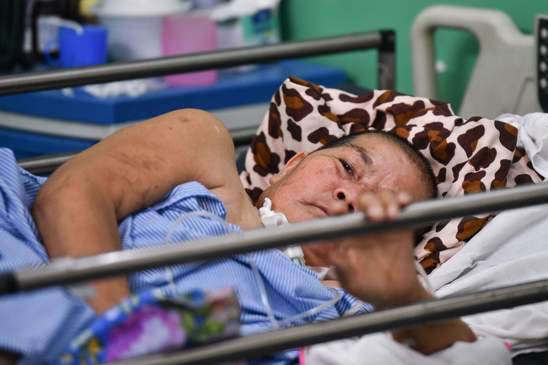 khu điều trị hậu Covid-19 nặng  ảnh 2 khu dieu tri hau Covid-19 nang anh 2