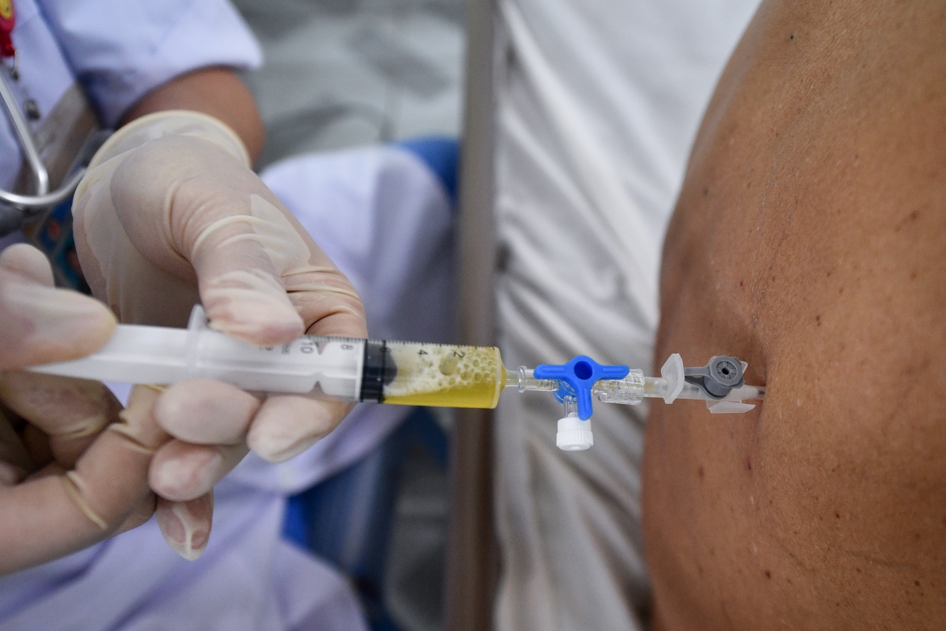 khu điều trị hậu Covid-19 nặng  ảnh 5 khu dieu tri hau Covid-19 nang anh 5