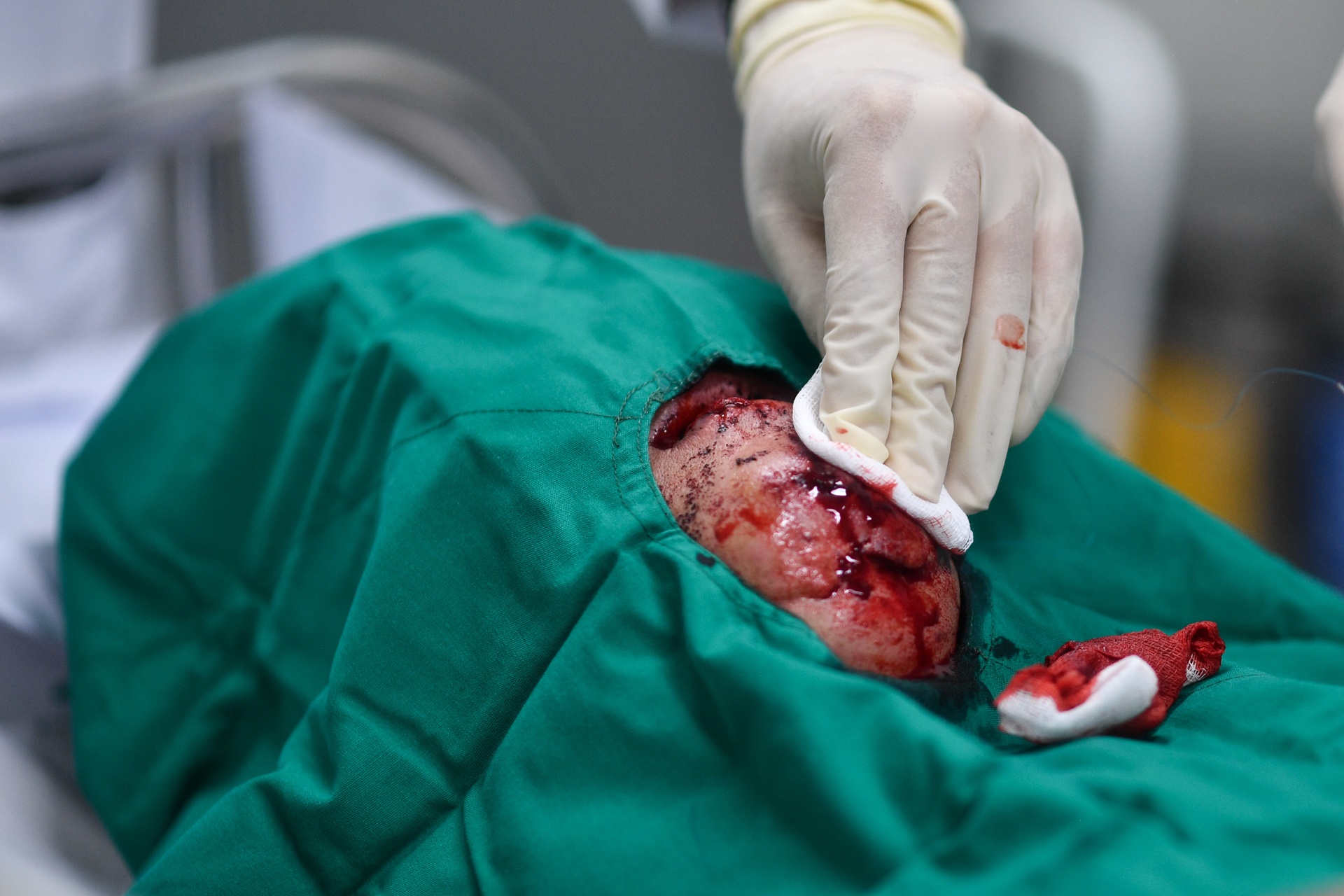 cap cuu tai nan Tet anh 3