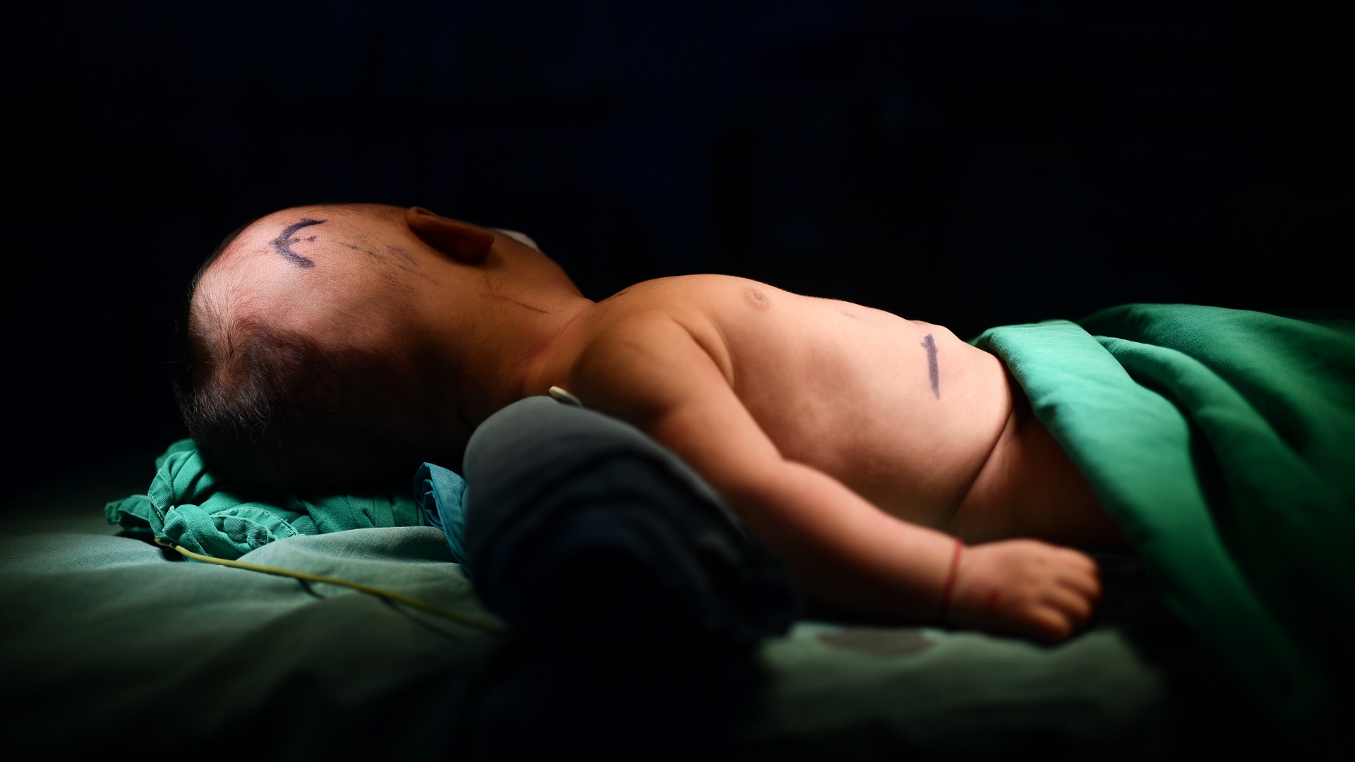 bac si be dau bu anh 9