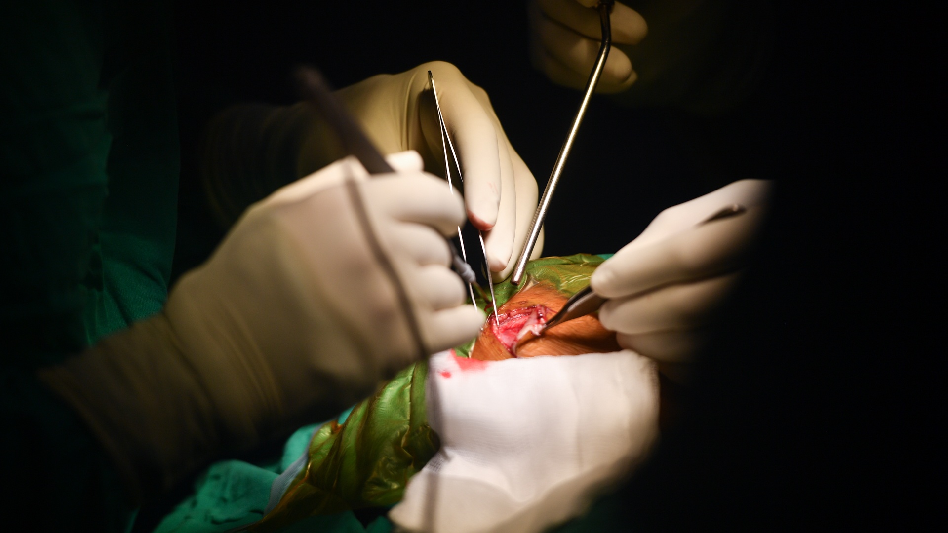 bac si be dau bu anh 12