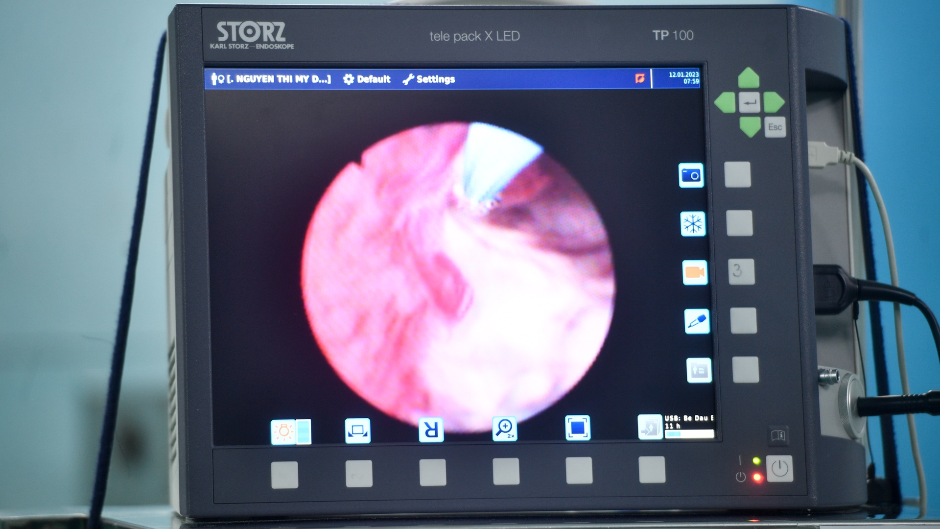 bac si be dau bu anh 16