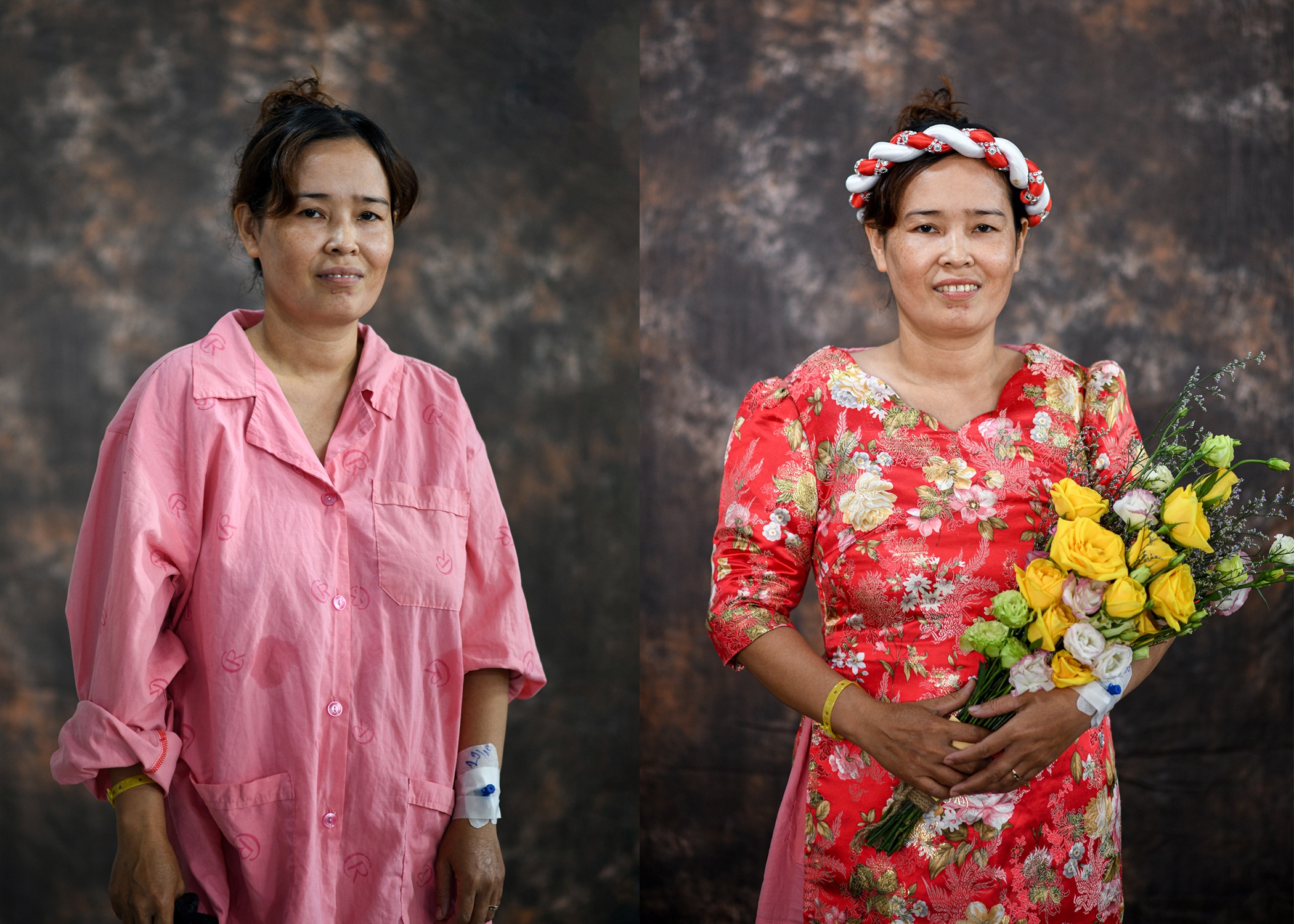 Bệnh viện Chợ Rẫy ảnh 2 Benh vien Cho Ray anh 2
