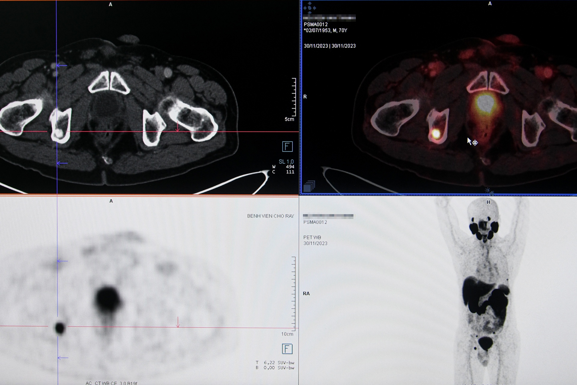 Dieu che thuoc phong xa anh 9