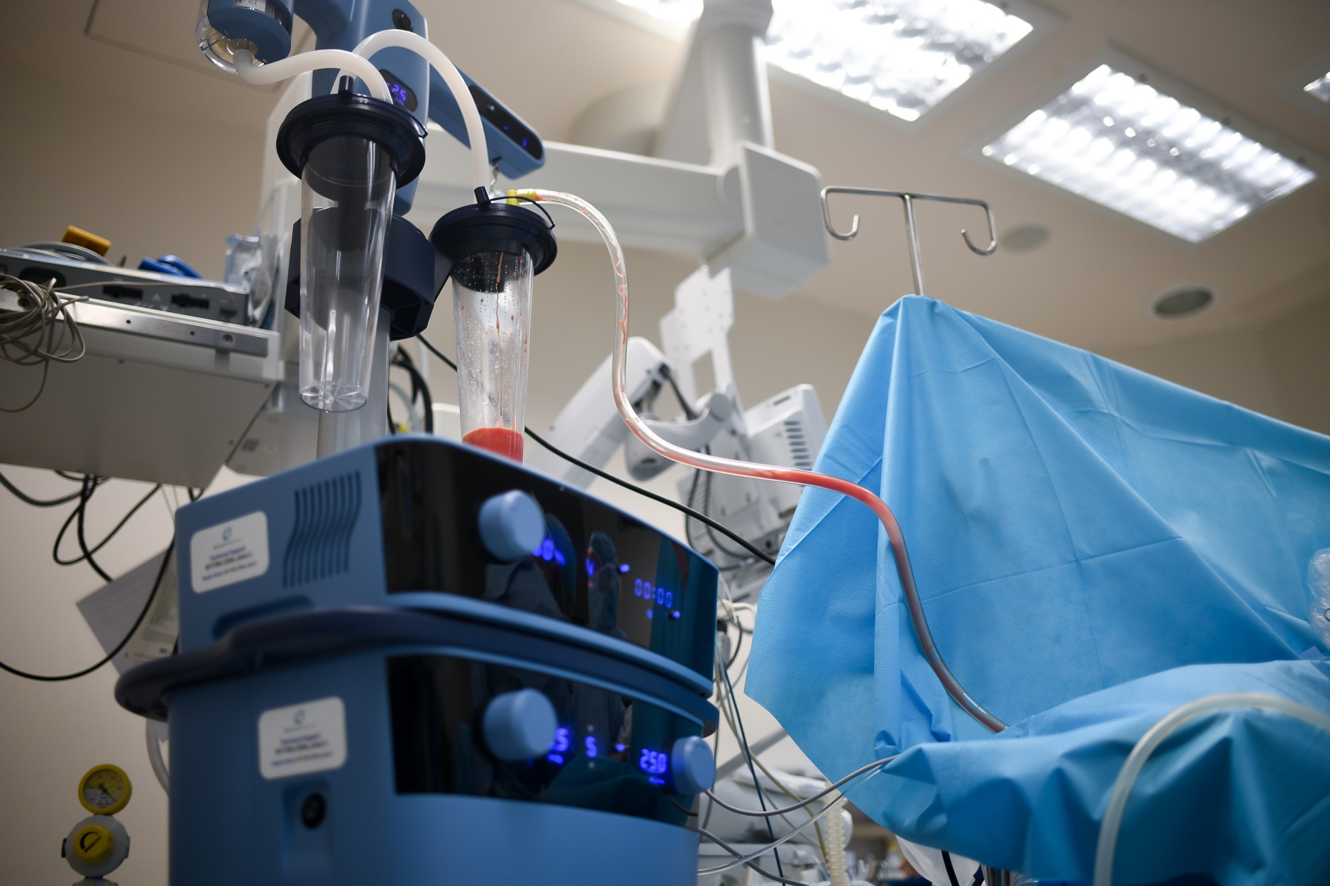 phau thuat hut mo anh 8