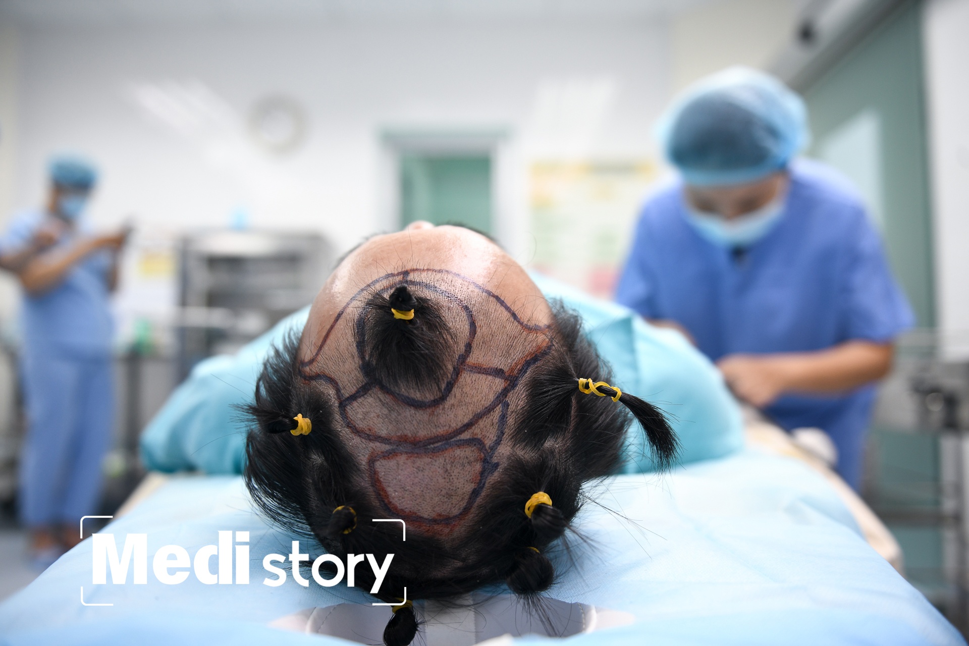 Can canh ca cay toc hon 70 trieu dong o TP.HCM hinh anh