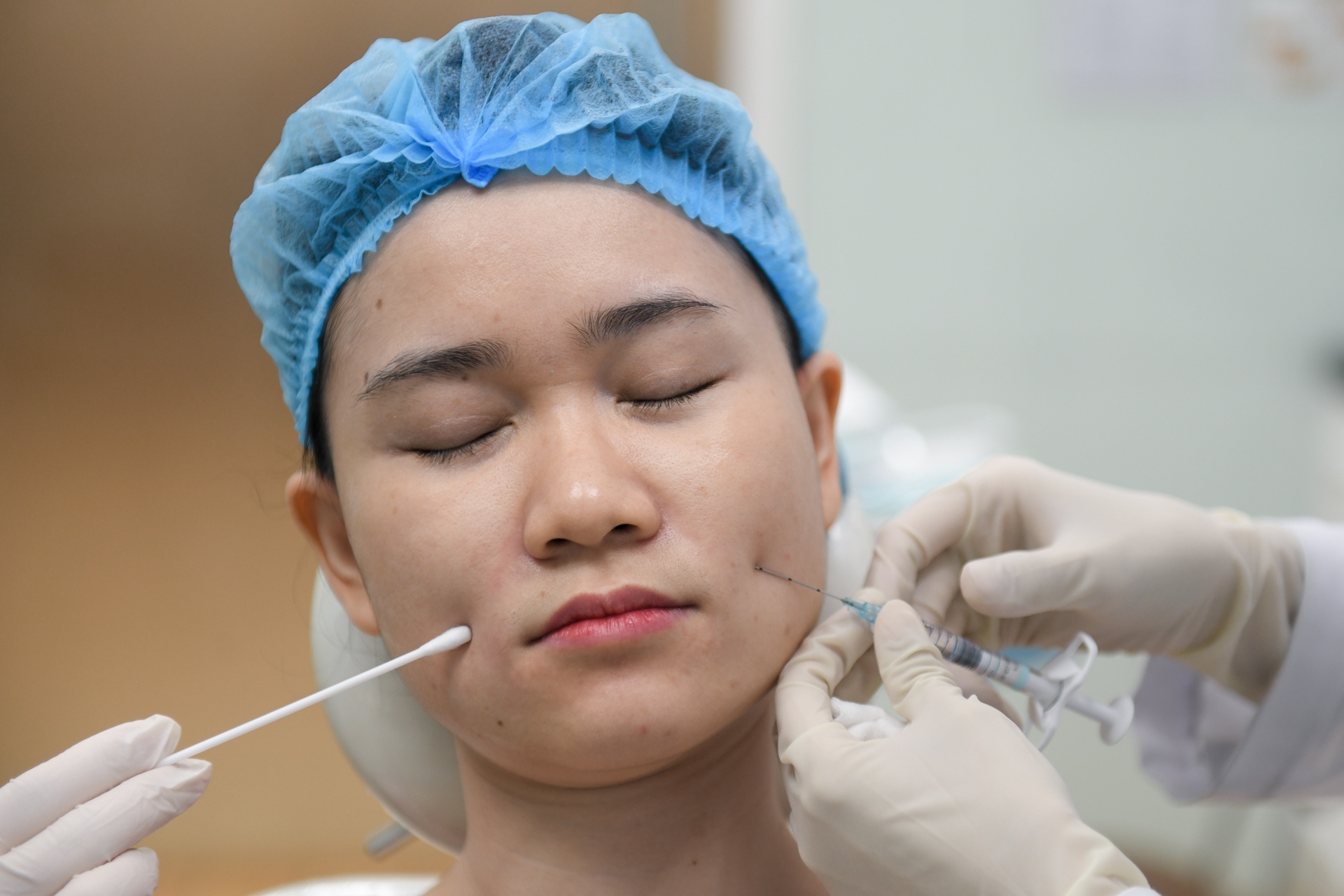 tiem filler mat anh 5