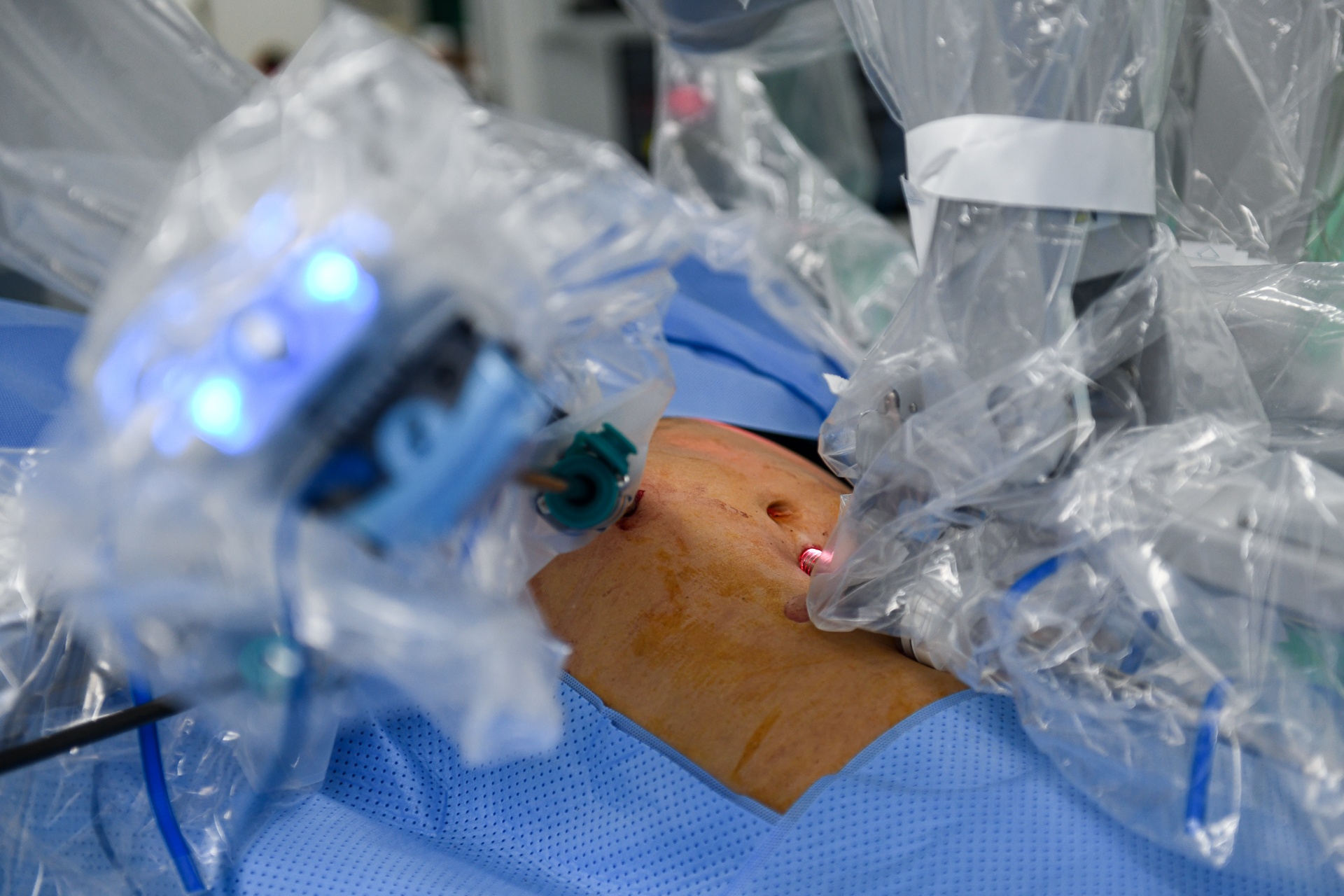 mo robot tai TP.HCM anh 7