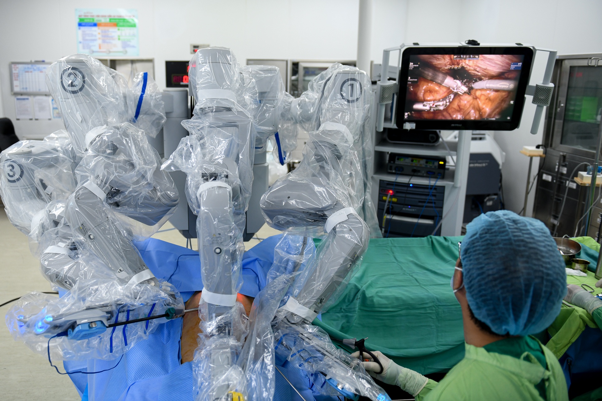 mo robot tai TP.HCM anh 6