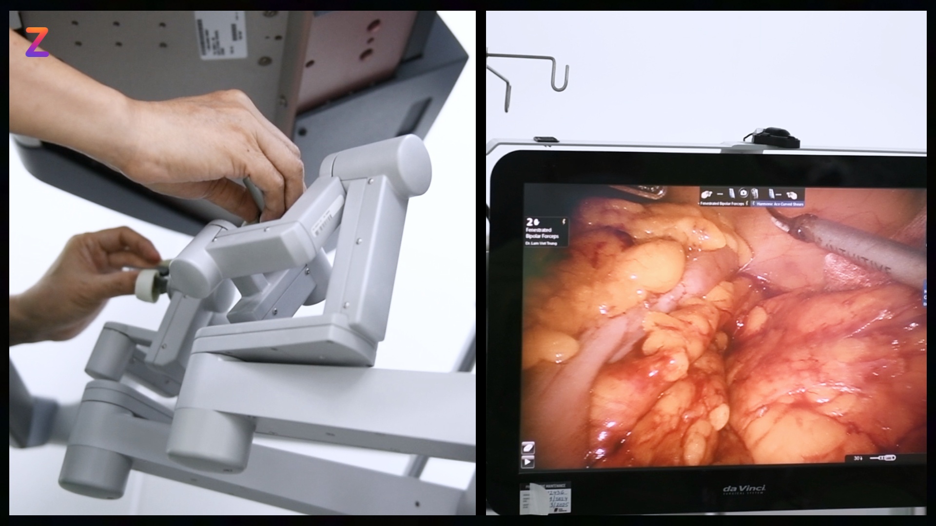 Can canh bac si dieu khien robot mo nhanh thoan thoat hinh anh