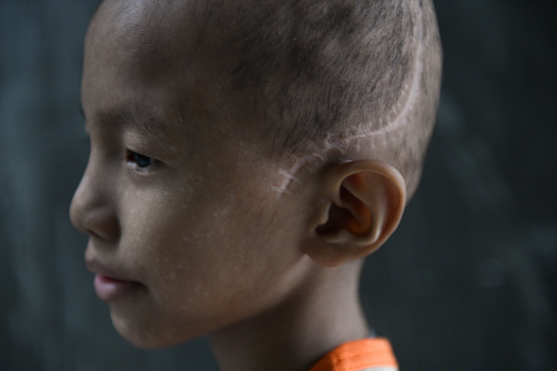 mat na nguoi nhen anh 3