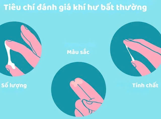 mau sac khi hu anh 1