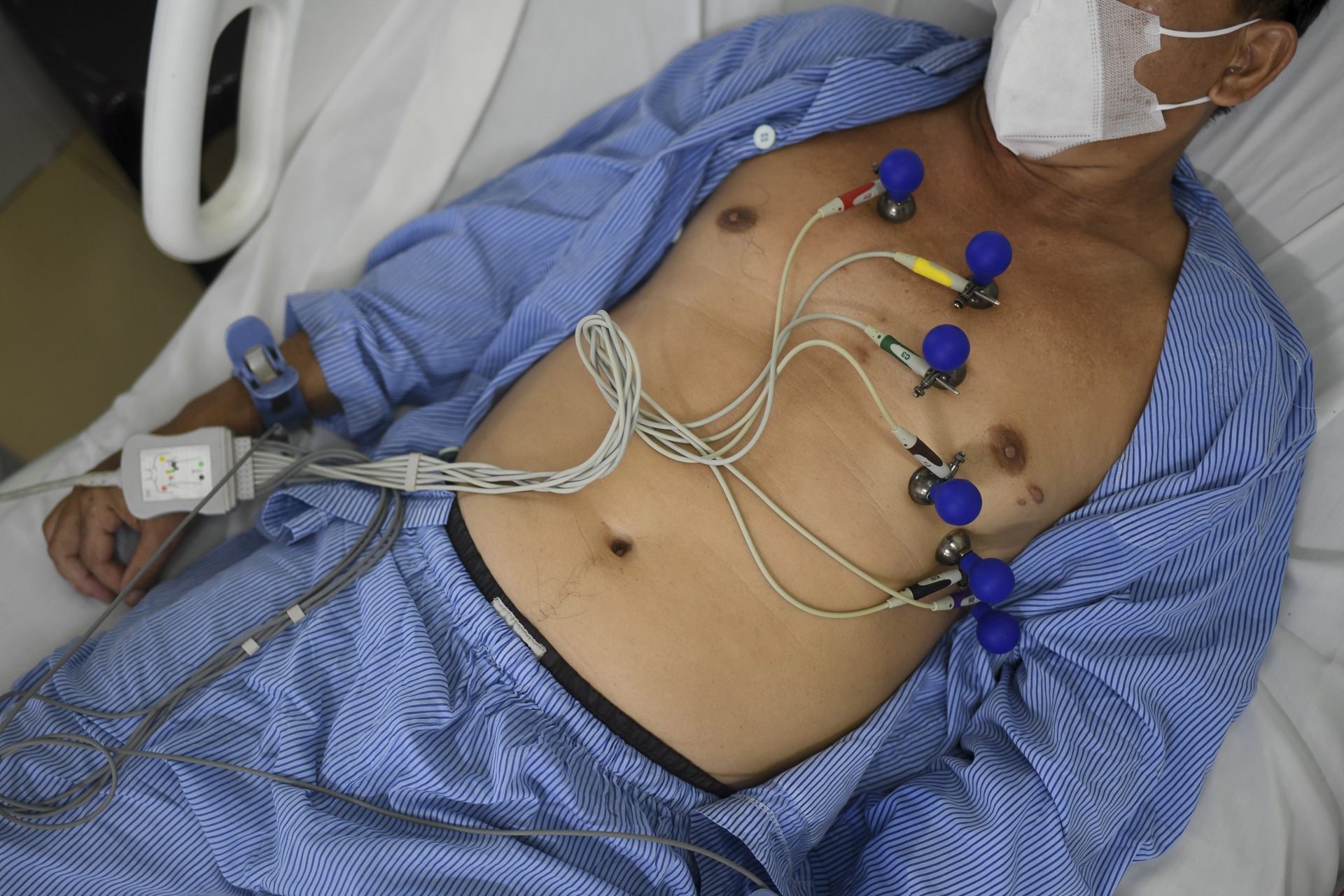 dieu tri dot quy anh 5