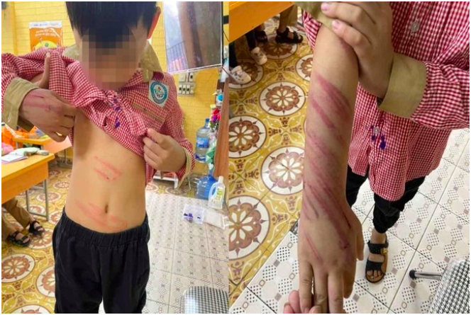 Che tai doi voi nguoi bao hanh be trai 7 tuoi hinh anh