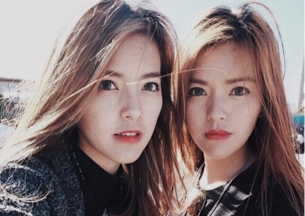 Lo dien em gai song sinh dep nhu hot girl cua Truc Anh The Face hinh anh