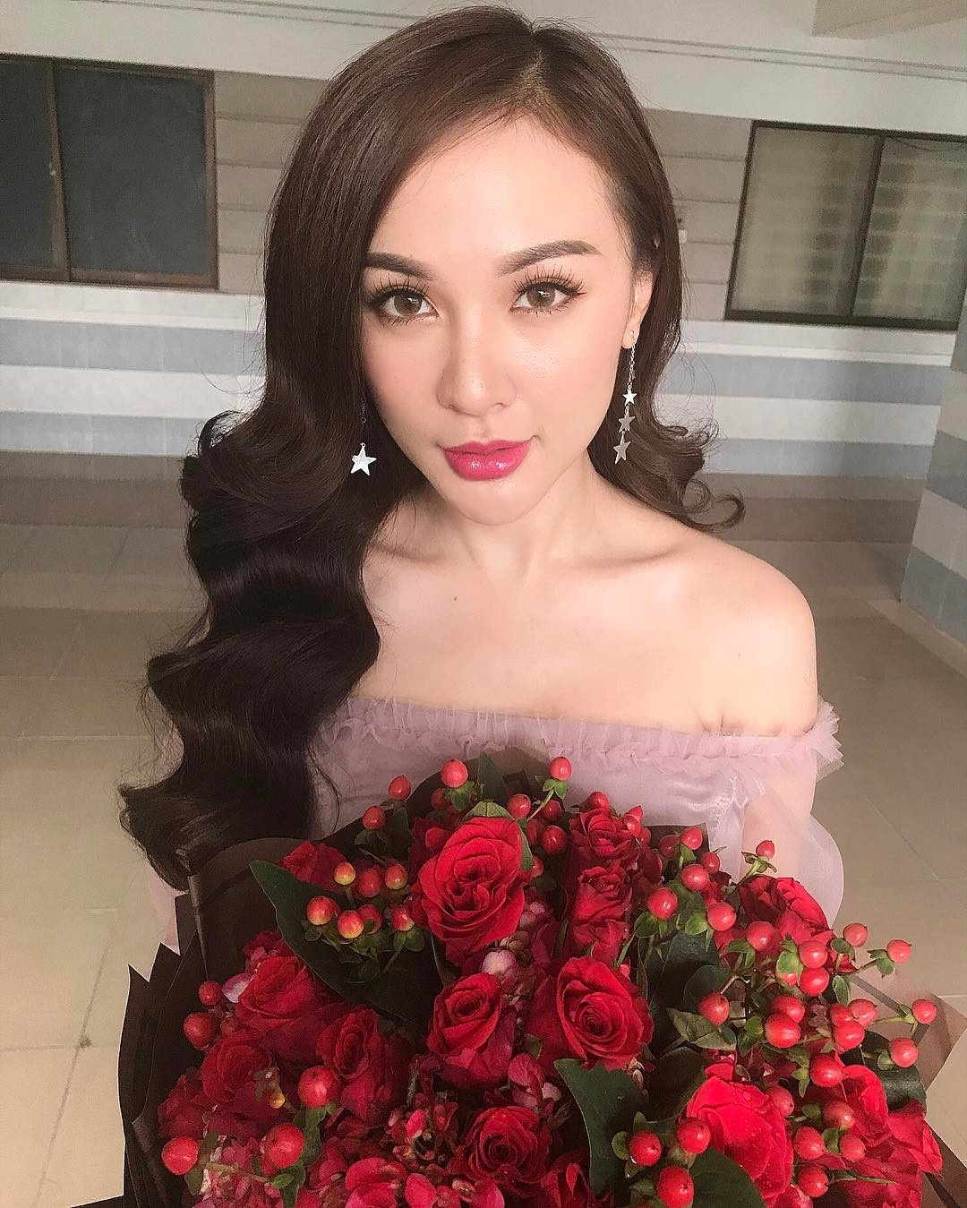 kelly nguyễn phẫu thuật thẩm mỹ ảnh 12 kelly nguyen phau thuat tham my anh 12