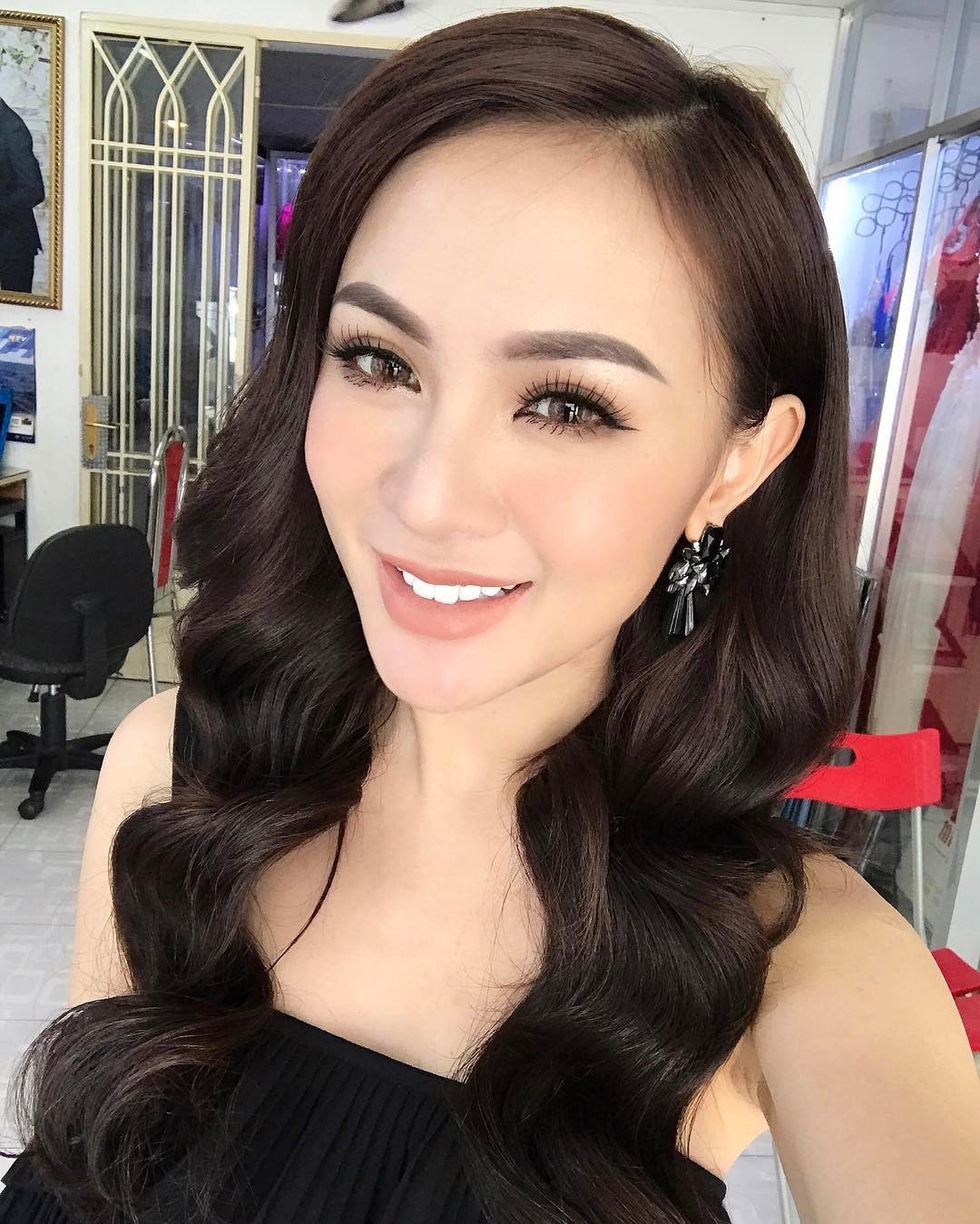 kelly nguyễn phẫu thuật thẩm mỹ ảnh 13 kelly nguyen phau thuat tham my anh 13