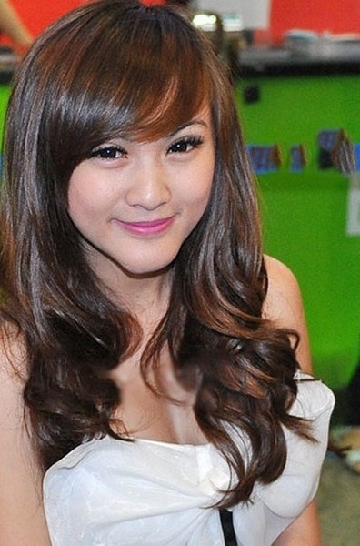 kelly nguyễn phẫu thuật thẩm mỹ ảnh 6 kelly nguyen phau thuat tham my anh 6