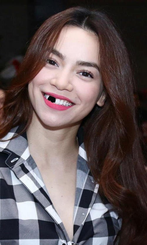 trào lưu chế ảnh sún răng ảnh 9 trao luu che anh sun rang anh 9