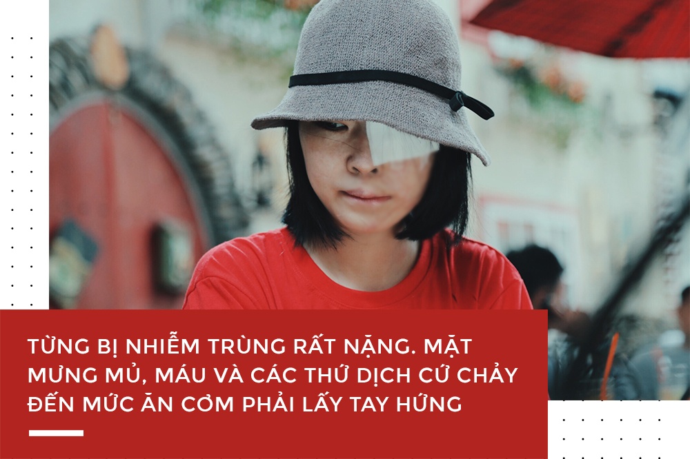 nữ sinh bị tạt axit ở sài gòn ảnh 3 nu sinh bi tat axit o sai gon anh 3