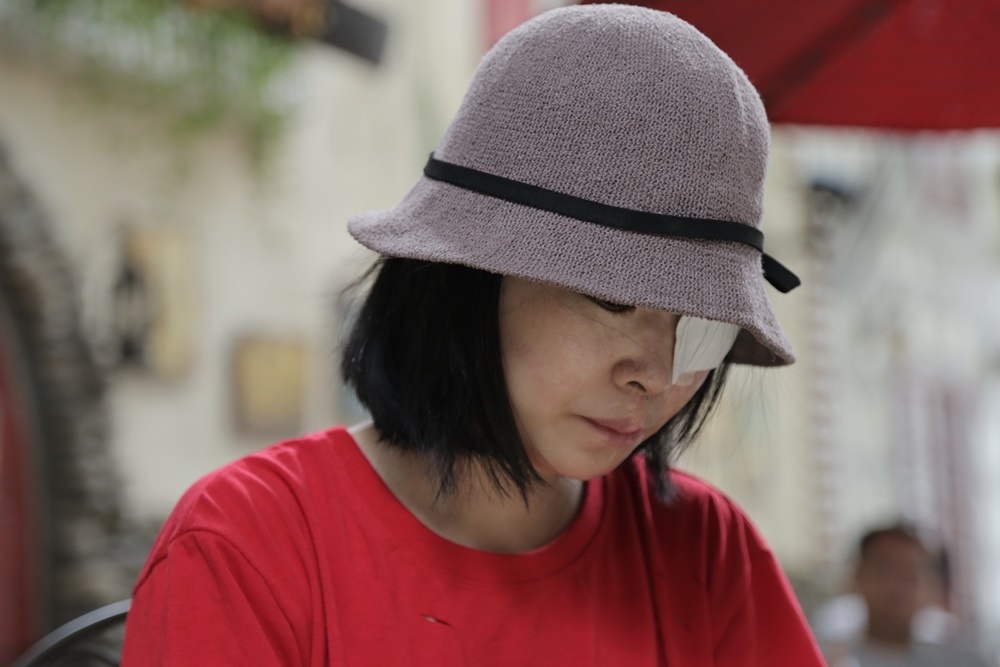 Nu sinh bi tat axit o Sai Gon chia se ve giai doan da qua hinh anh