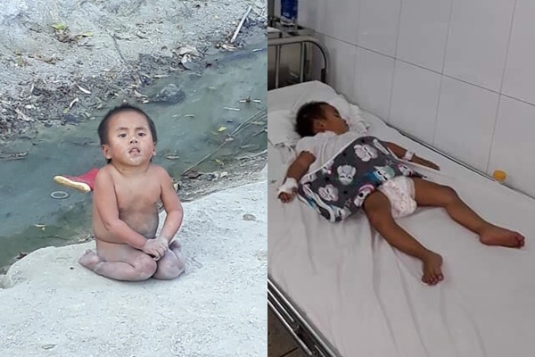 Em be o Muong Lat duoc vo chong Sai Gon nhan nuoi phai nhap vien hinh anh