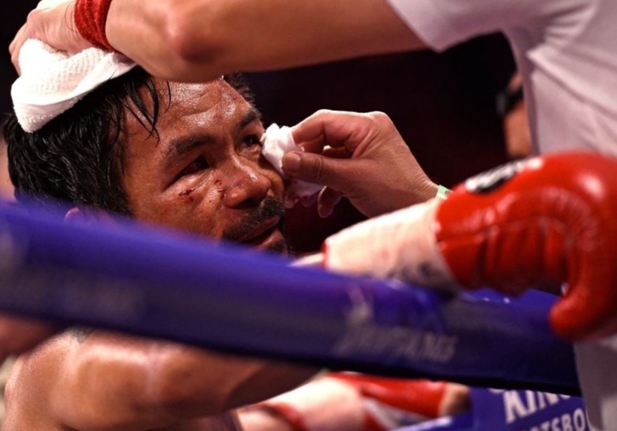 Pacquiao bi dau mat sau tran tranh dai WBA Super hinh anh