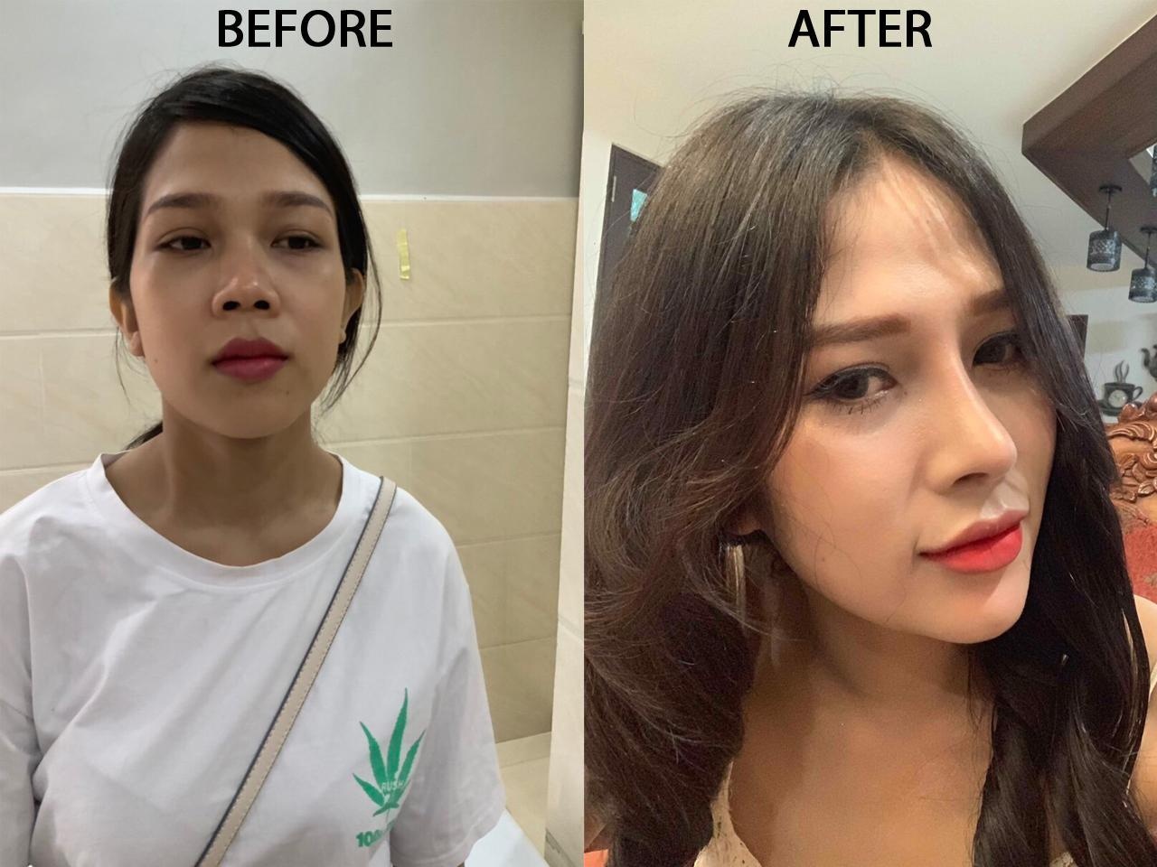 Viện thẩm mỹ quốc tế Pháp Việt ảnh 4 Vien tham my quoc te Phap Viet anh 4