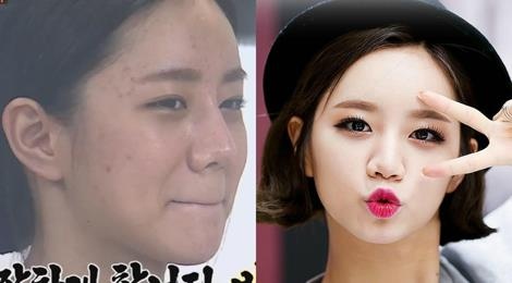 Trang diem qua nhieu khien lan da cua sao Han san sui, noi mun hinh anh