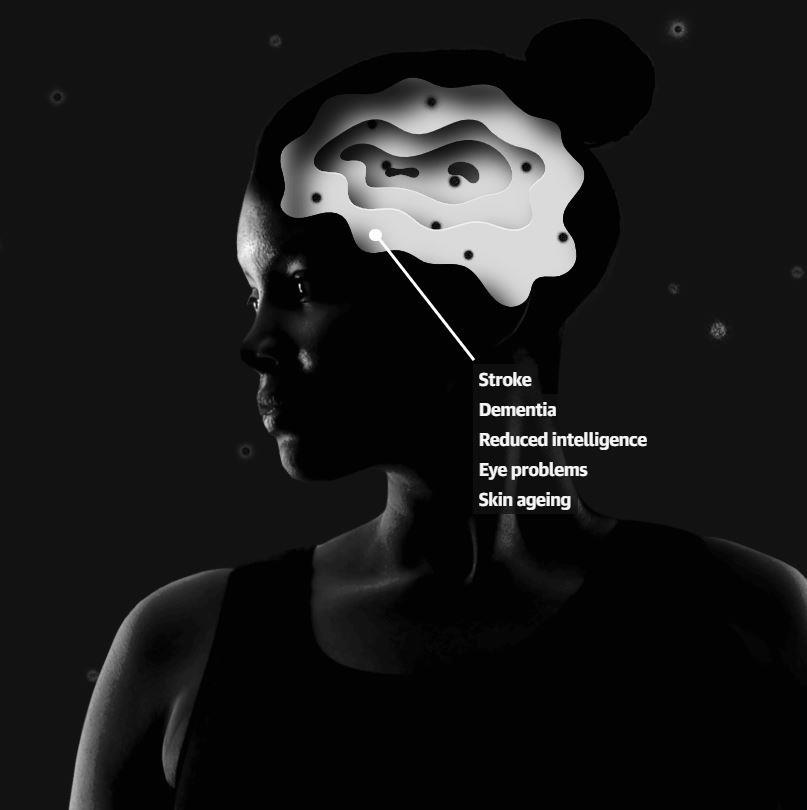 o nhiem khong khi Ha Noi anh 5