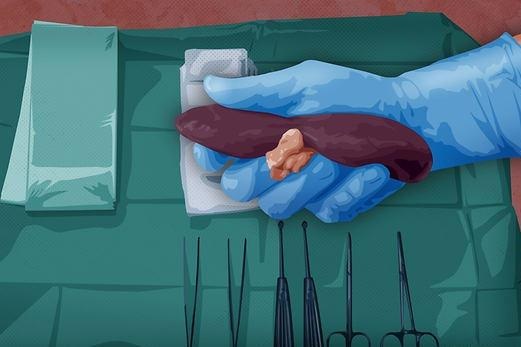 Cho den ban than o Philippines lua doi, huy hoai cuoc doi dan ngheo hinh anh