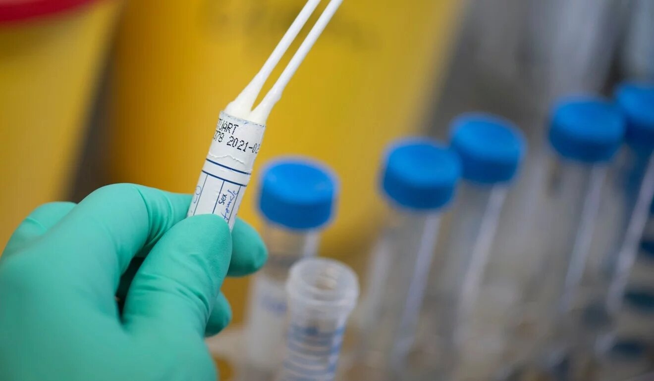 He mien dich chong virus corona anh 3