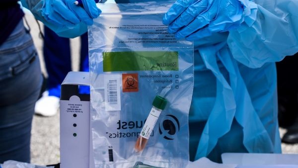 viem phoi tu vong covid-19 anh 2