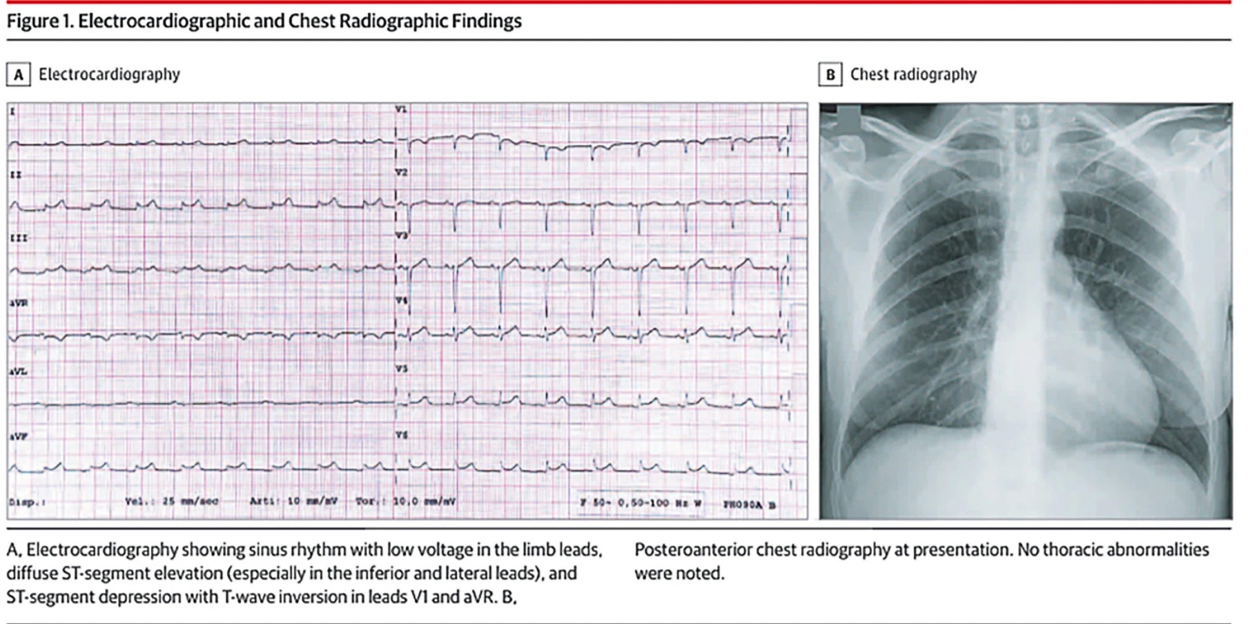 dau tim virus corona anh 2