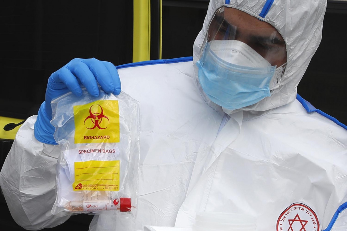 xet nghiem nhanh covid-19 anh 2