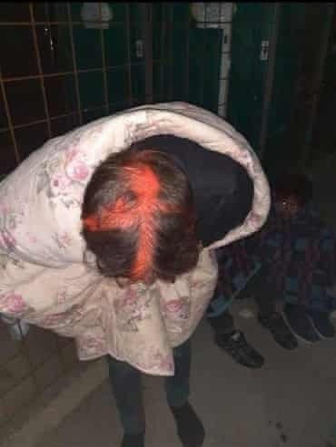 son dau nguoi ti nan anh 2