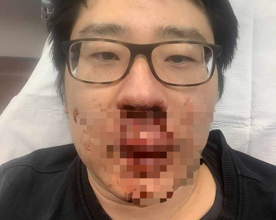 Giang vien Trung Quoc bi danh chay mau mui o Anh hinh anh