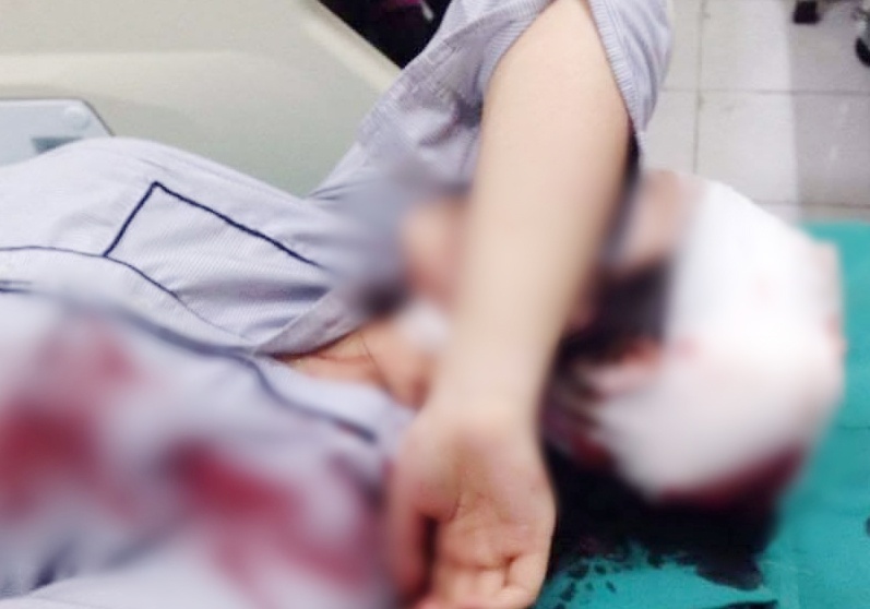 Mau thuan vi 'nhin deu', nu sinh lop 10 bi danh guc giua duong hinh anh