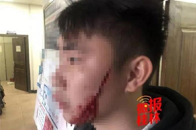 Rach mat ban trai vi doi chia tay hinh anh