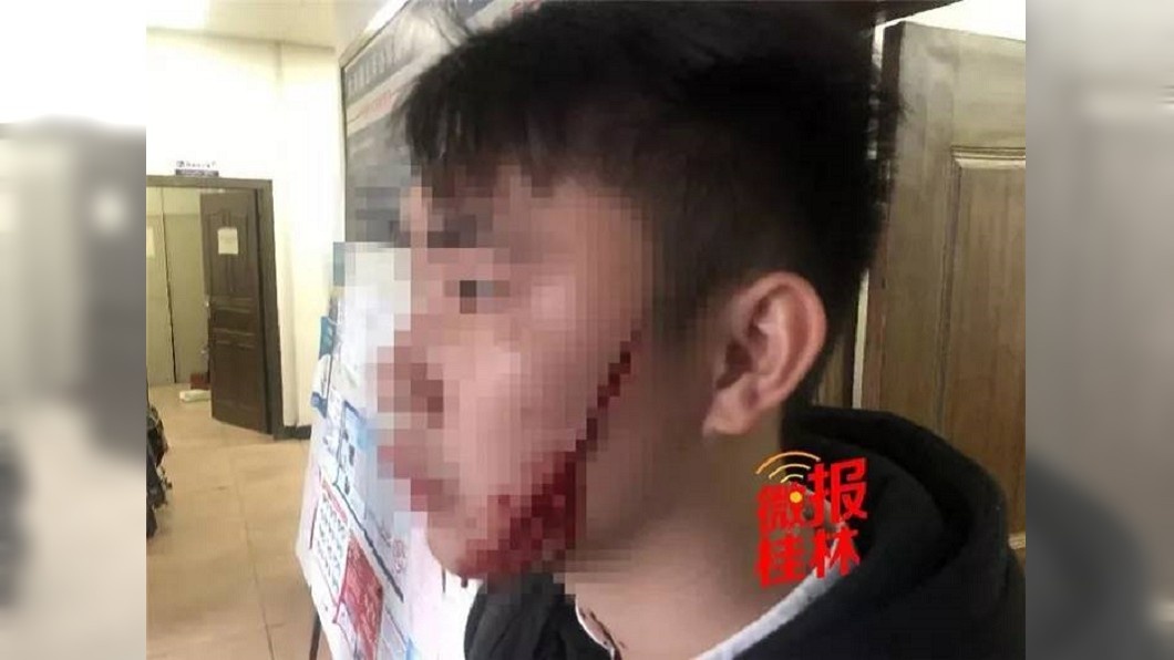 Rạch mặt người yêu vì chia tay ảnh 2 Rach mat nguoi yeu vi chia tay anh 2