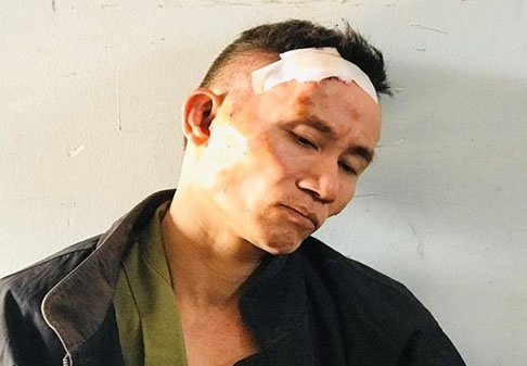 Ga om luu dan co thu o TP.HCM bi khoi to 3 toi danh hinh anh