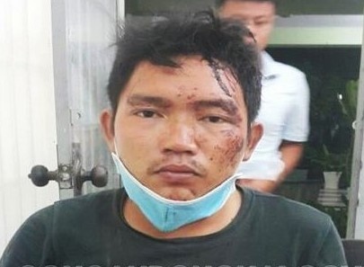 Ga trai dung dao khong che dong nghiep de cuop 600 trieu hinh anh