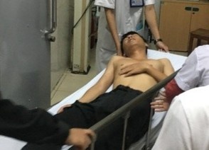 Chan dua xe trai phep, CSCD bi tong gay chan hinh anh